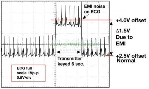 1.5 英尺以外的發(fā)射器（f = 470 MHz, P= 0.5W）開啟和關(guān)閉時(shí)ECG 診斷設(shè)備的心臟檢查結(jié)果