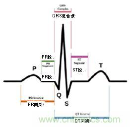 心電圖中的 P-QRS-T波