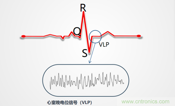 解決心電監(jiān)測行業(yè)難題，曼森伯格的濾波技術(shù)獲國家知識產(chǎn)權(quán)局發(fā)明授權(quán)